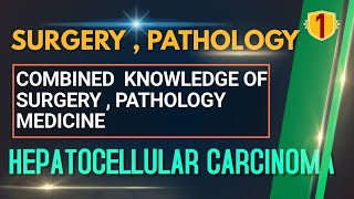 SURGERY 01  HEPATOCELLULAR CARCINOMA  Malignant Tumor of Liver PATHOLOGY LECTURE SURGERY LECTURE [upl. by Thorwald]