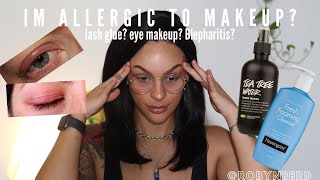 ALLERGIC TO MAKEUP OR LASHES BLEPHARITIS  ROBYNBERD [upl. by Eel]