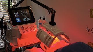 3D Skintech Facial Treatment  Skin Rejuvenation  Facials at The Body Clinic [upl. by Jule]