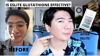 ESLITE SACETYL GLUTATHIONE REVIEW  ALTERNATIVE TO IV THERAPY  PUMUTI AT KUMINIS 30 DAYS OF USE [upl. by Adnohrahs]