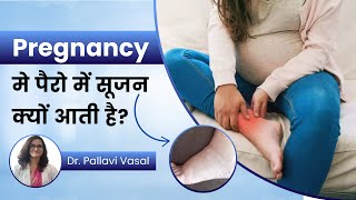 How to Reduce Swelling in Legs During Pregnancy Dr Pallavi Vasal [upl. by Adelric]