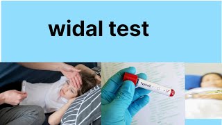 widal test हिन्दी मे  widal test kya h Typhoid disease investigation [upl. by Poland]