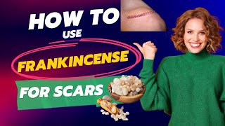 Benefits of Frankincense Oil Frankincense For Scars [upl. by Aleck908]