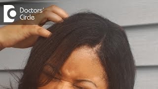 Reasons for itchy scalp and how to treat it  Dr Rasya Dixit [upl. by Ecnarolf858]