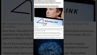 It Finally happenedElon Musk Implants Neuralink into Human Brain [upl. by Talley979]