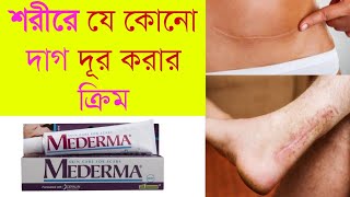 kata dag dur korar ghoroa upay  mederma cream price [upl. by Akcimahs]