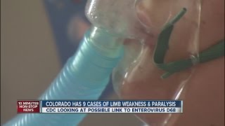 Colorado has 9 cases of limb weakness paralysis [upl. by Ienttirb583]