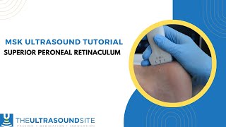 MSK ultrasound of the Superior peroneal retinaculum [upl. by Gant]