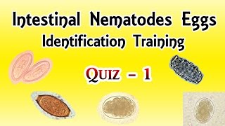 Intestinal Nematodes Eggs Identification Training Quiz 14 [upl. by Staford]