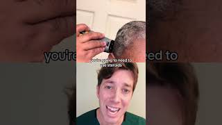 How to Get Rid of Dandruff  Seborrheic Dermatitis [upl. by Ojimmas147]