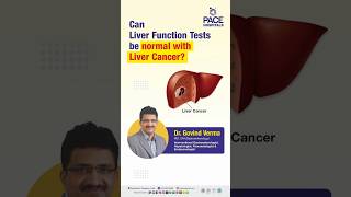 Can Liver Function Tests be normal with Liver Cancer  liverfunctiontests shorts trending [upl. by Miof Mela861]