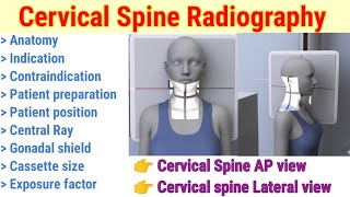 Cervical Spine Radiography  AP amp Lateral Projection  Patient position  In hindi  By BL Kumawat [upl. by Ramos525]