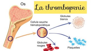 les étiologies des thrombopénies [upl. by Alidis]