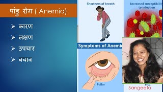 Anemia or pandu rog  causes  Symptoms  teatment  sangeeta [upl. by Desta]