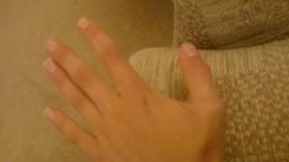 Can you dislocate your thumb [upl. by Follmer]