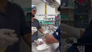 Intubation newborn baby ♥️ [upl. by Hawk108]