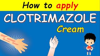 Clotrimazole cream Lotrimin How to apply  Uses and Side effects [upl. by Roid697]