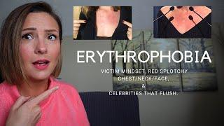 WHY AM I BLUSHING Erythrophobia Victim Mindset Red Splotchy Chest Neck amp Face [upl. by Rebecka]