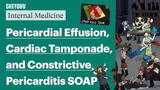 Pericardial Effusion Cardiac Tamponade amp Constrictive Pericarditis Part 1 Internal Medicine [upl. by Rodriguez]