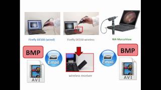 Video Otoscope Comparison [upl. by Arahahs]