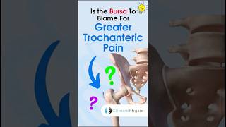 Greater Trochanteric Pain anatomy physiotherapy physicaltherapy gtps hippain [upl. by Marigolda974]