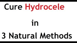 Natural ways to treat Hydrocele [upl. by Ellett496]