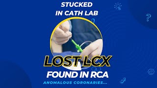 Aberrant Circumflex arising from Right Coronary Artery cardiology heart angiography lcx [upl. by Haughay]