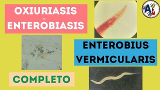 ENTEROBIASIS U OXIURIASIS  Enterobius vermicularis completo [upl. by Arjan66]