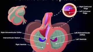 Ventral View of Ventricle and Heart Outflow Tract Septation [upl. by Cila117]