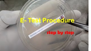 MIC test Procedure E Test Procedure Epsilometer test E test Procedure step by step [upl. by Scottie]