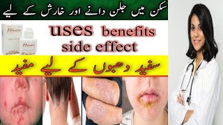 hivate lotion Mometasone uses benefit side effect complete review of hivate lotion in Urdu Hindi [upl. by Lutero]