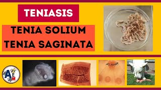 TENIASIS  Taenia solium y saginata [upl. by Ulrika]