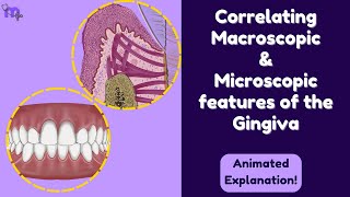 Correlation of the Macroscopic amp Microscopic features of the Gingiva  Periodontology  Animated [upl. by April484]