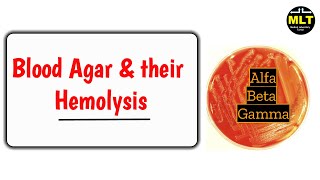 Blood agar and Hemolysis Test  Types of hemolysis on blood agar [upl. by Urba]