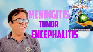 Meningitis Tumor Encephalitis [upl. by Sheehan814]