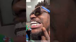 Kodak Black Shows New Grills [upl. by Hambley]