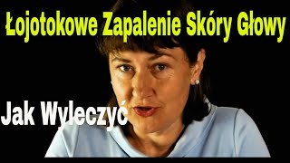 Łojotokowe zapalenie skóry głowy Jak wyleczyć [upl. by Vachel253]