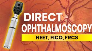 Direct Ophthalmoscopy Tips and Tricks [upl. by Ellicott132]