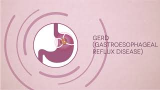 Gastrointestinal Problems amp Symptoms  Digestive System Diseases  Fortis Bangalore [upl. by Notnilk]