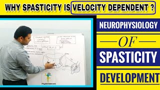 NEUROPHYSIOLOGY OF SPASTICITY DEVELOPMENT MECHANISM OF HYPERACTIVE STRETCH REFLEX [upl. by Eixel198]