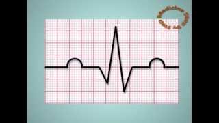 Understanding ECGs  EKG [upl. by Samaria]