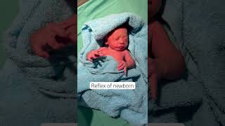 Reflex of newborn baby cute newborn cutebaby shortsfeed shortsviral shortsyoutube shortvideo [upl. by Orimlede]