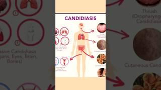 candidiasis 🦠 The fungal infection medical biology [upl. by Aimil]