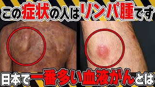 【日本で一番多い血液がん】絶対に見逃さないで！悪性リンパ腫の初期の危険サインとは？予防法についても医師が徹底解説！【医師監修】【悪性リンパ腫は】 [upl. by Ardaid]