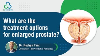 Understanding treatment options for enlarged prostate [upl. by Nedloh]