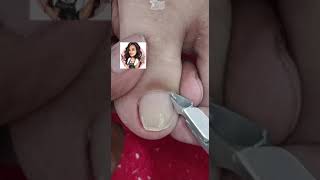 Satisfying Toe Cleaning  Relaxing Foot Care amp Deep Clean ASMR 100 [upl. by Ellon292]