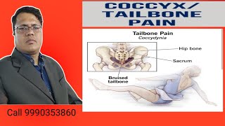 Tail Bone painCoccyx bone pain Cure in Neurotherapy Haldwani [upl. by Abdella271]