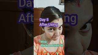 WOW Black Seed hair oil review Day 5 hairfall wow [upl. by Euqnomod]