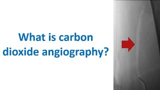 What is carbon dioxide angiography [upl. by Garik]