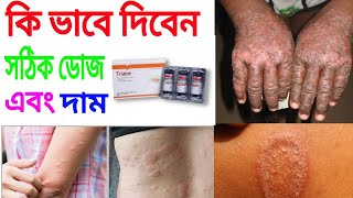 trialon ইনজেকশন এর কাজ কি full review Bangla [upl. by Kline]